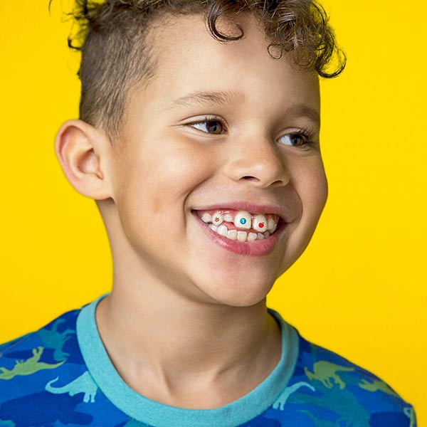 Invisalign España – Invisalign Europe